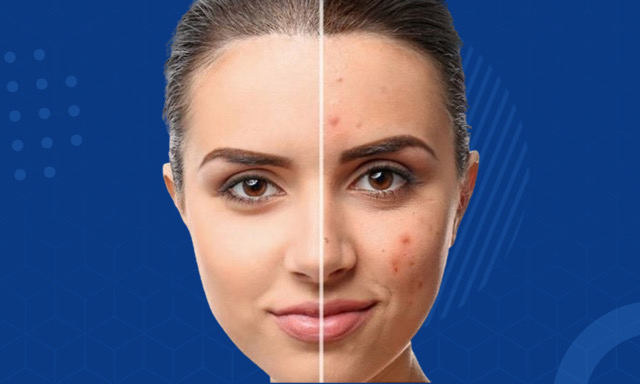 باقة تحاليل الروكتان