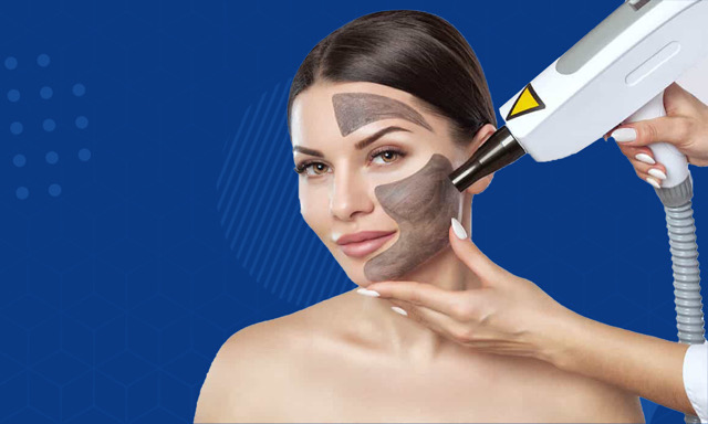 ليزر كربوني