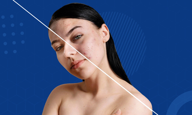 جلسة فراكشنال