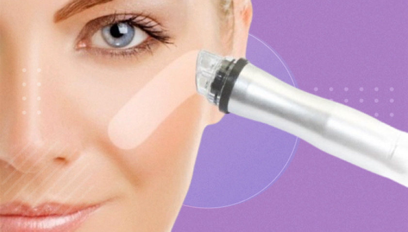 جلسة تنظيف عميق أكوا كلين