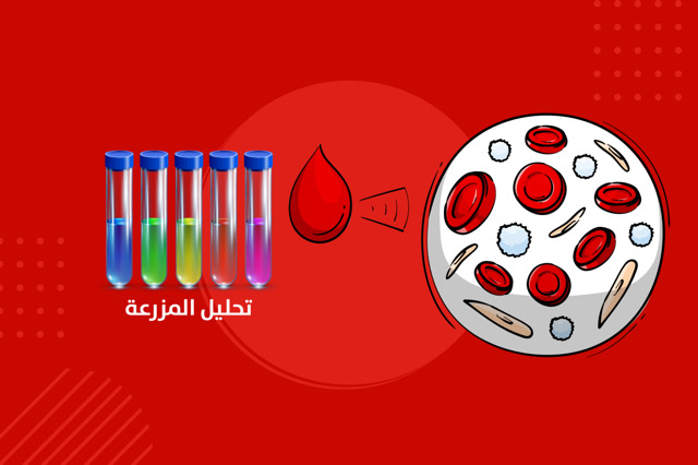 تحليل المزرعة