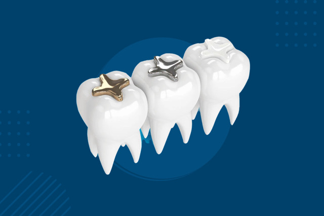 حشوة كومبوزت صنف اول