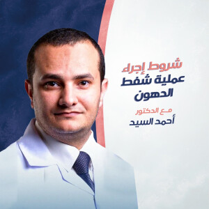 يتحدث د. احمد السيد عن شروط اجراء عملية شفط الدهون - مدونة قوابا