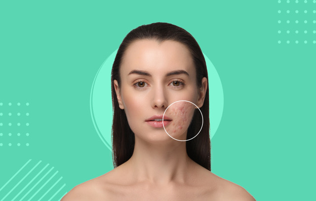 باقة الروكتان