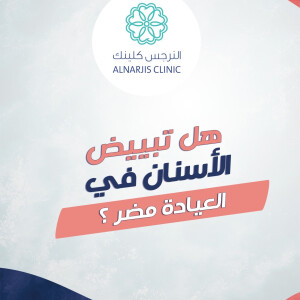 تجيب د. منه فؤاد عن تساؤلات هل تبييض الاسنان في العيادة مضر ؟ - مدونة قوابا
