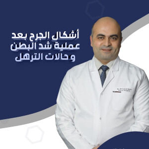 يشرح د. محمد عزمي عن أشكال الجرح بعد عملية شد البطن و حالات الترهل. - مدونة قوابا
