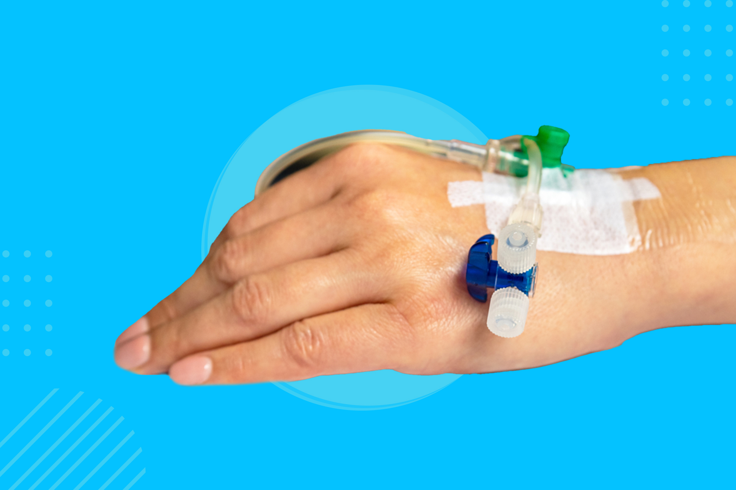 ابرة المغذي الوريدي