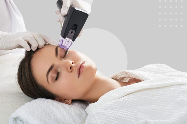 صورة عرض 3 جلسات مورفيس للوجه