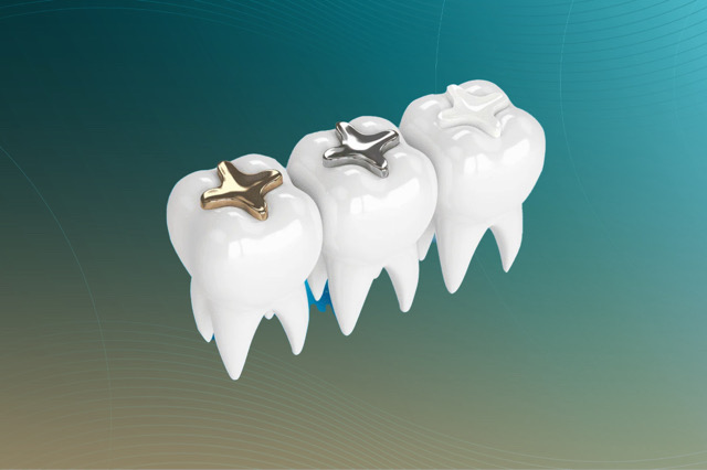 حشوة الأسنان التجميلية