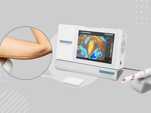 صورة عرض أتيفا للذراعين